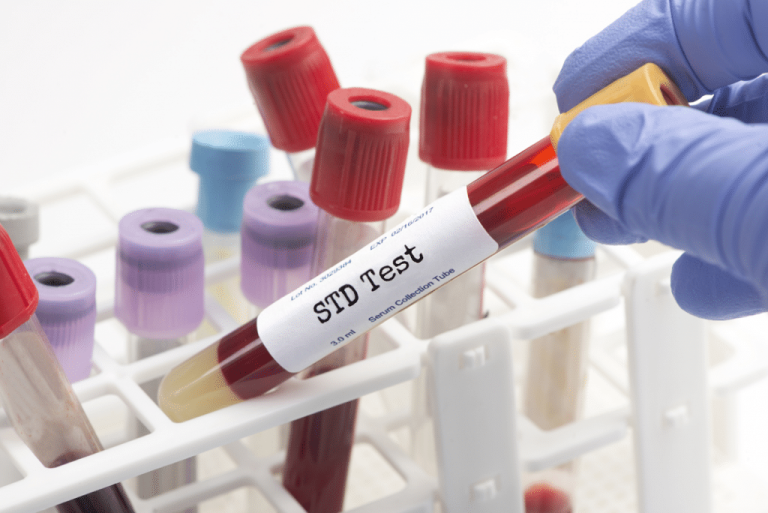 A Guide to STI/STD Testing